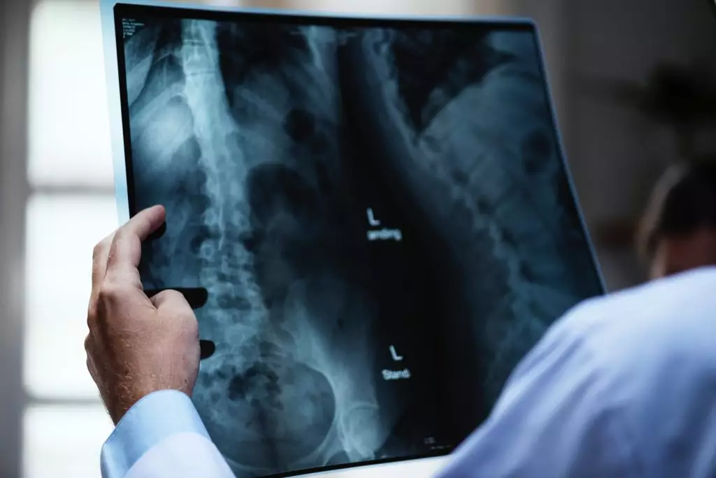 A doctor reviewing a medical x-ray.